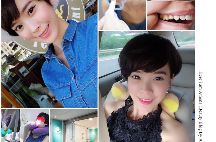 [美牙] 白要全方位。我要當個自信微笑的女孩兒♥