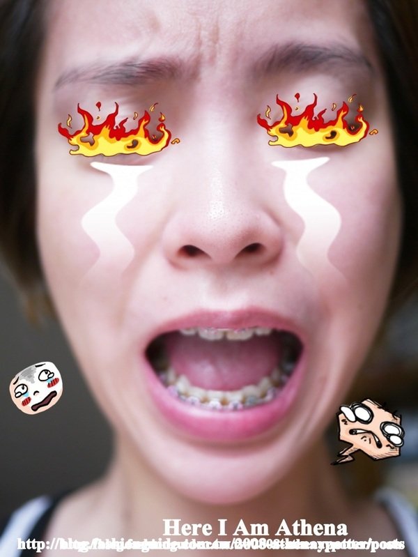 一年八個月的牙套心得～痠又來找我了